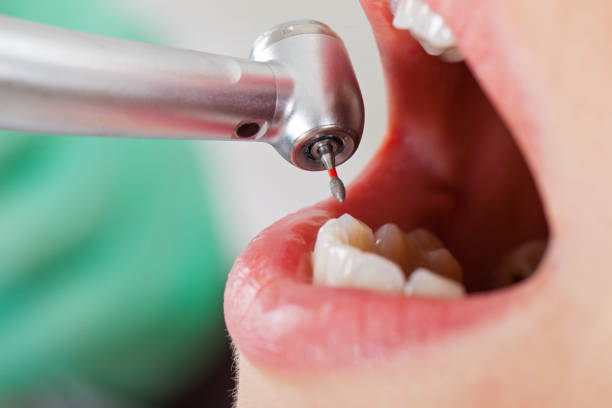 Best Emergency Denture Repair in USA